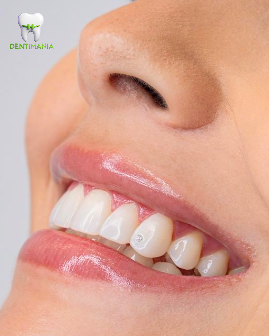 Estética Dental Diamante
